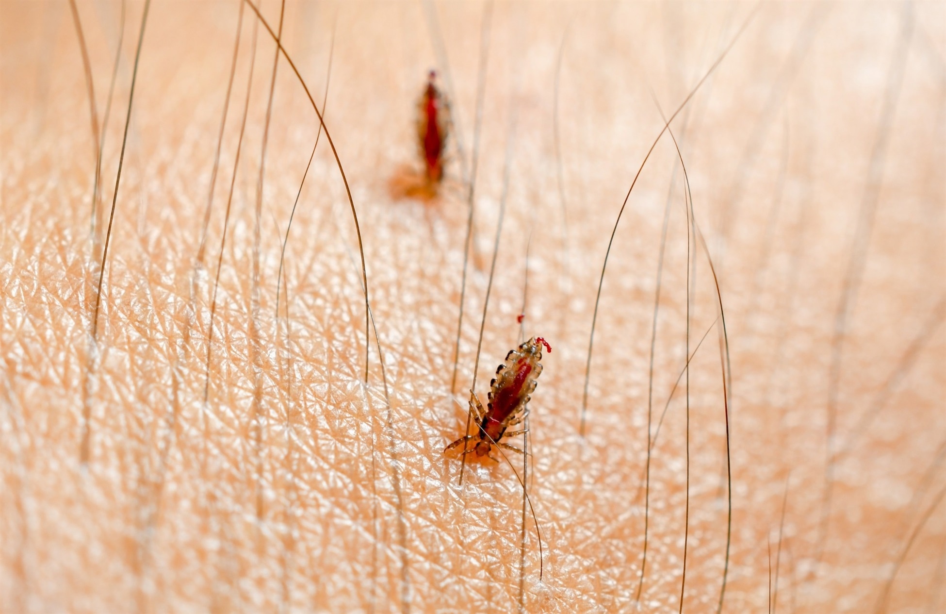 Body Lice